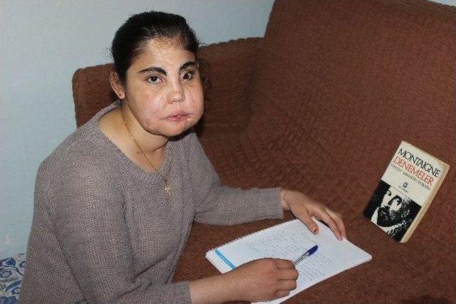 Türkiye’nin Yüzlü Nakli Yapılan İlk Kadını Son Yolculuğuna Uğurlandı