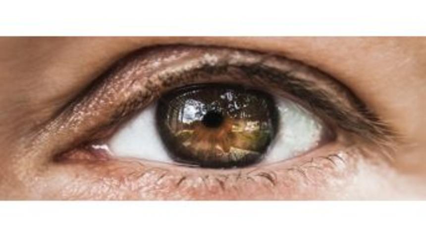 G&ouml;zde Işık &Ccedil;akmasına Dikkat