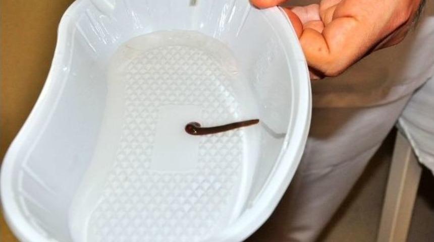 Burnundan &Ccedil;ıkana İnanamadı