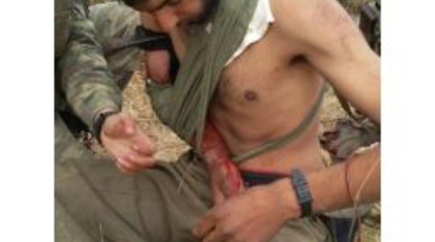 Askerden Yaralı Pkk’lıya İlk Müdahale