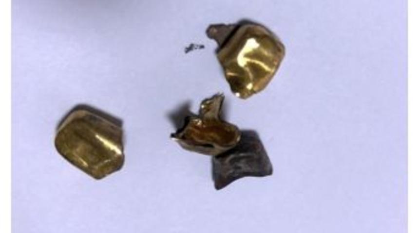 Kuyumcuya Sahte Altın Diş Satmaya &Ccedil;alıştı