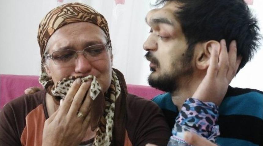 İnsanların Bakışından Rahatsız Oldu, Sanatla Hayata Tutundu