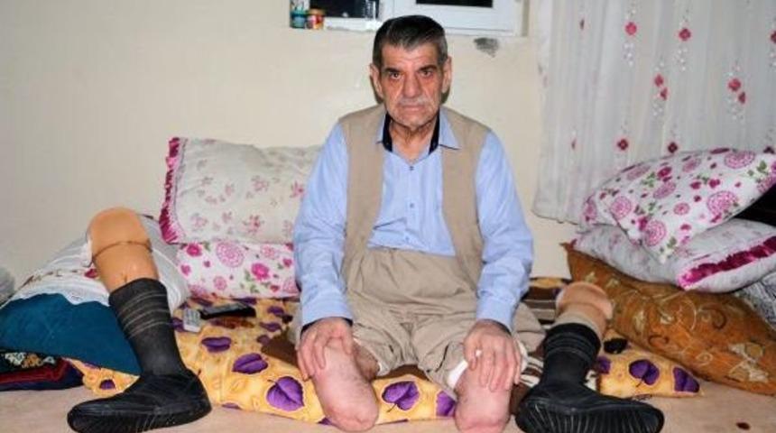 45 Yıl I&ccedil;tiği Sigara Y&uuml;z&uuml;nden 2 Bacağını Kaybetti