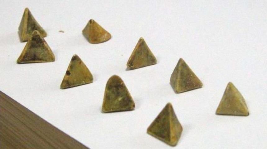 Safra Kesesinden &Ccedil;ıkan Piramit Şeklindeki Taşlar Şaşırttı