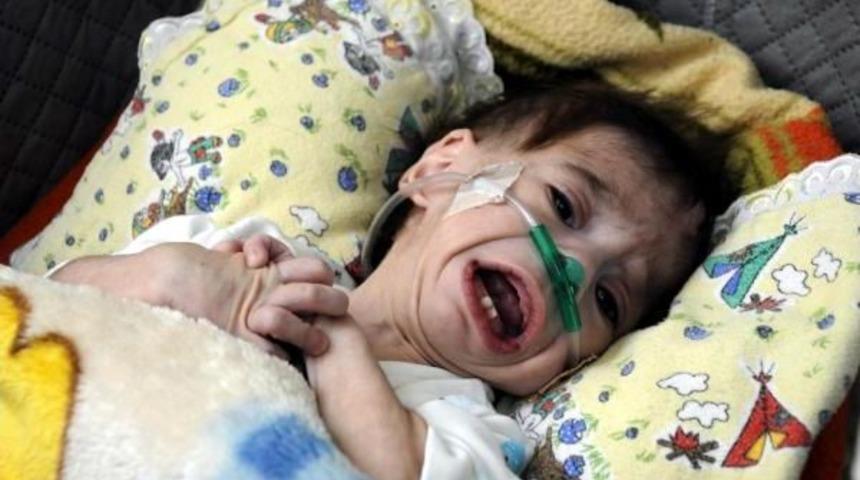 Kalp Hastası Minik Abdulkadir Yardım Bekliyor