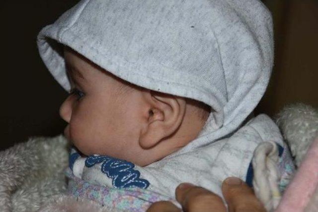 Suriyeli Bebek Ve Anneyi Fareler Kemirdi 1