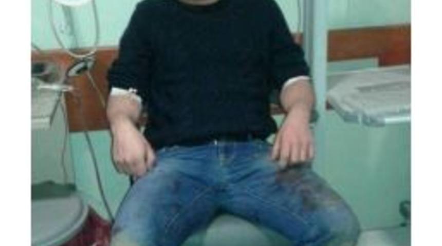 Eski Alaplı İl&ccedil;e Jandarma Komutanı &Ccedil;atışmada Yaralandı