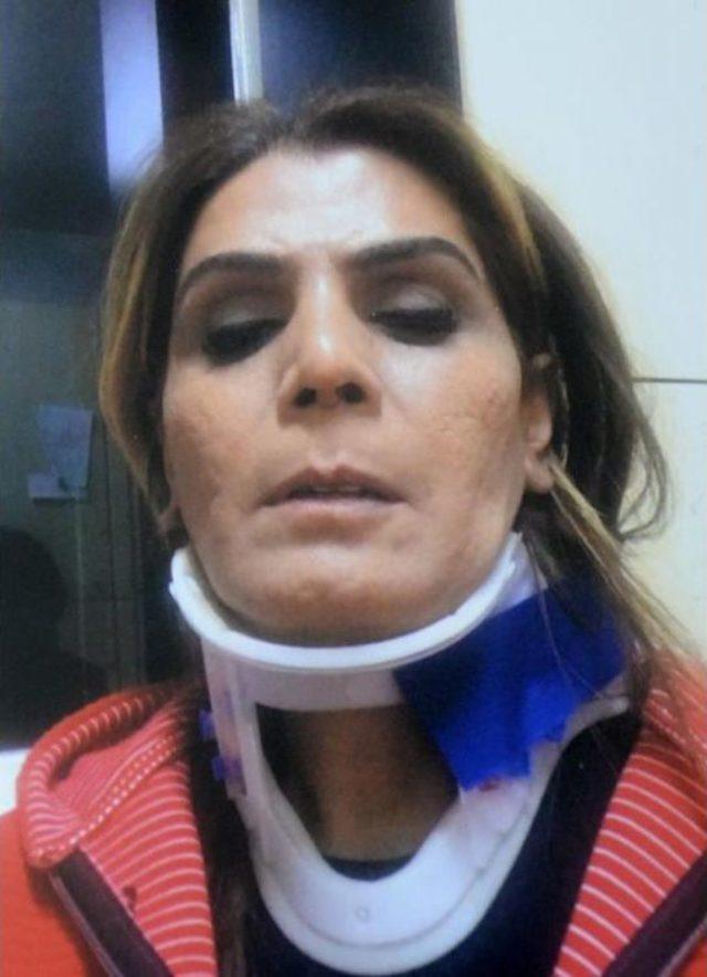 Saldırıyla Su&ccedil;ladığı Eski Sevgilisini Şikayet Etti 1