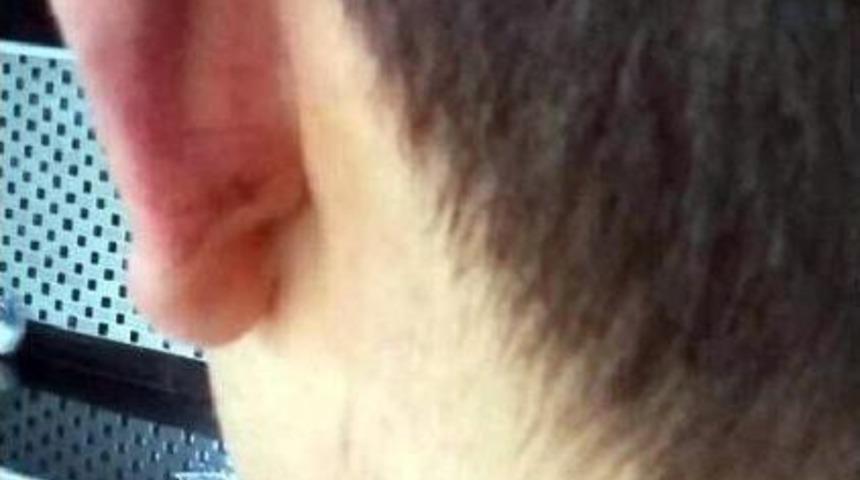 Şişeye Oturtma Girişiminin 'hakaret' Su&ccedil;u Sayılmasına Itiraz