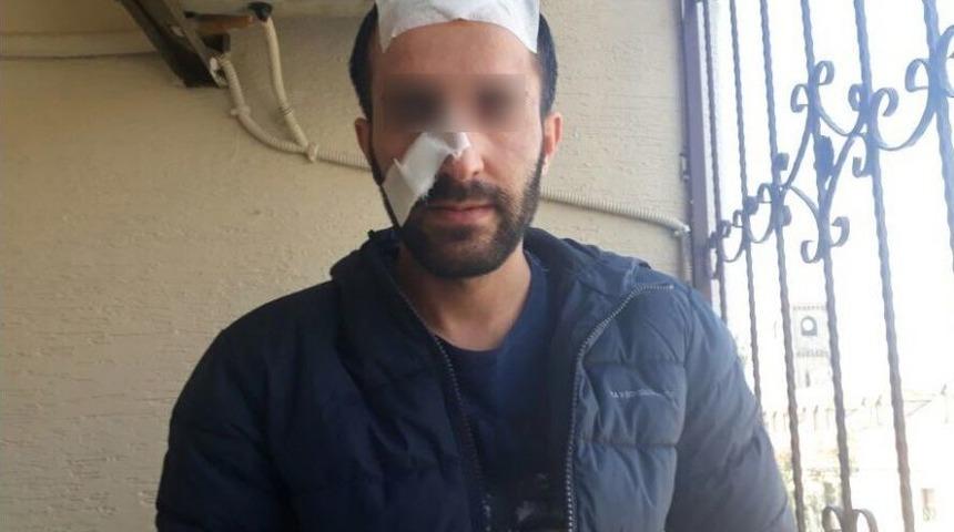 Fuhuş İ&ccedil;in Gittiği Evde D&ouml;v&uuml;l&uuml;p Gasp Edildi