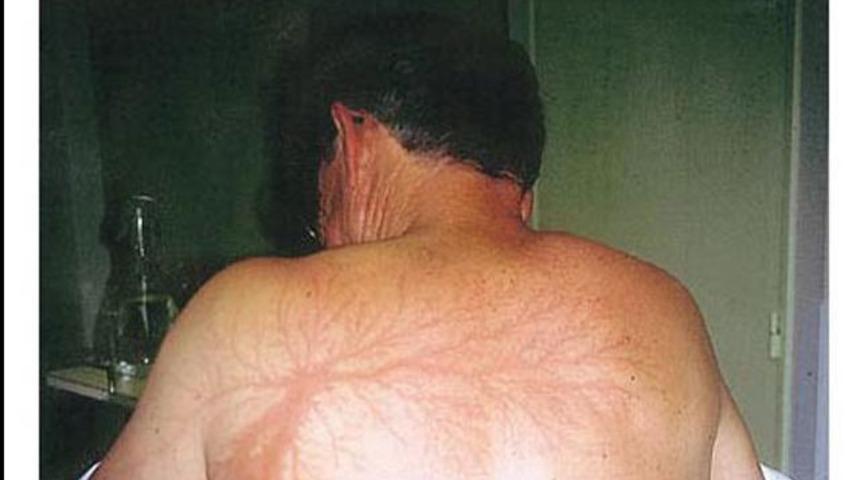 Yıldırım &ccedil;arpanlara ne oluyor?