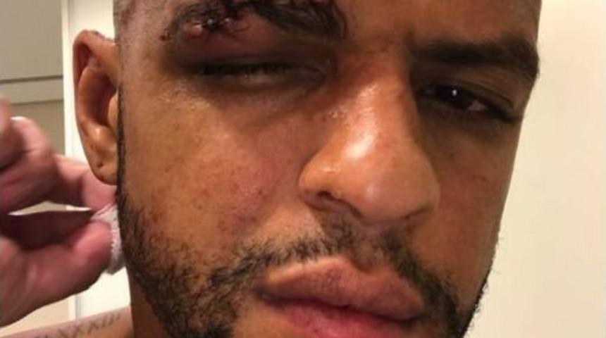 Galatasaray&rsquo;ın Eski Yıldızına Bakın Ne Oldu