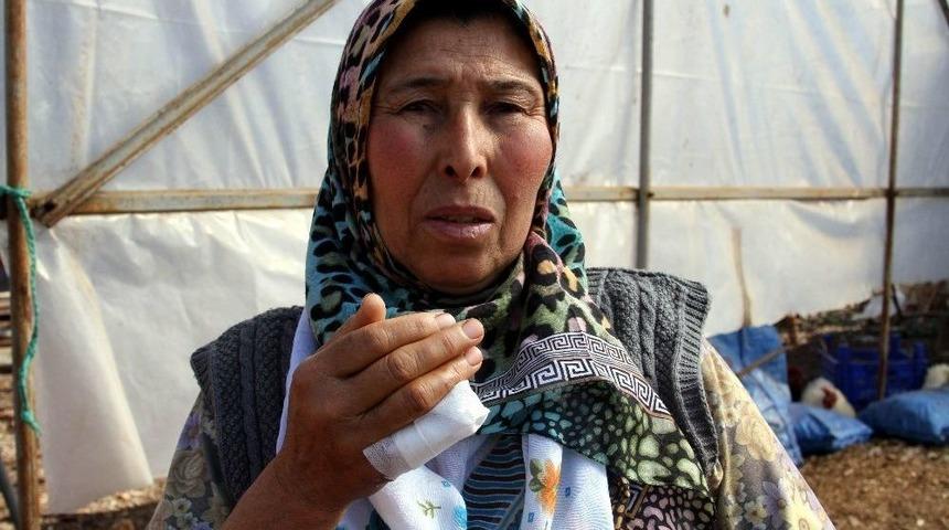 Kavgada Isırılarak Kopartıldığı İddia Edilen Parmak Mahkemeye Taşınıyor