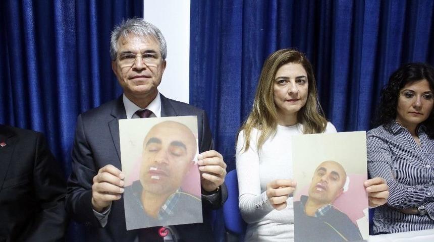 Antalya&rsquo;da Doktora Demir &Ccedil;ubuklu Darp