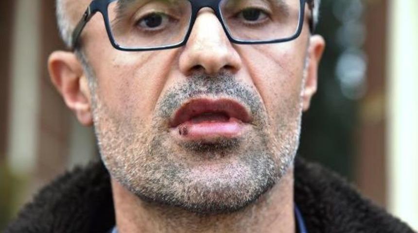 Do&ccedil;ente Demir &Ccedil;ubukla Bayıltan Dayak (2)