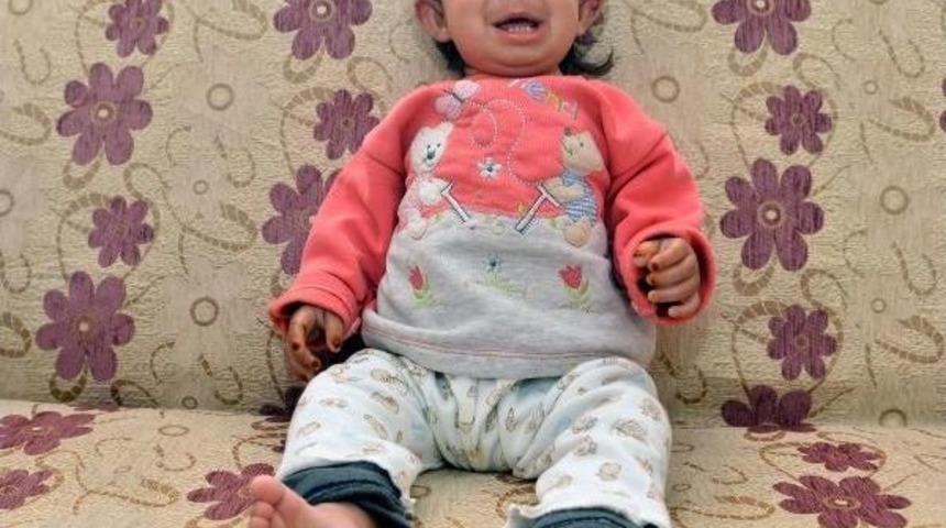 Minik Bebeğin Cildi S&uuml;rekli Kanıyor