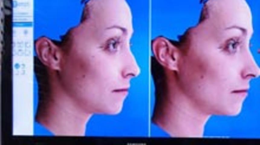 Estetikle Nasıl G&ouml;r&uuml;n&uuml;rs&uuml;n&uuml;z?