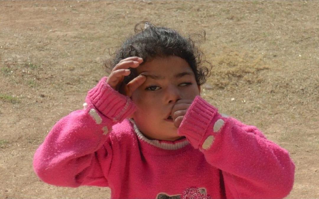 G&ouml;z Kapaklarını Parmaklarıyla A&ccedil;arak G&ouml;rebiliyor