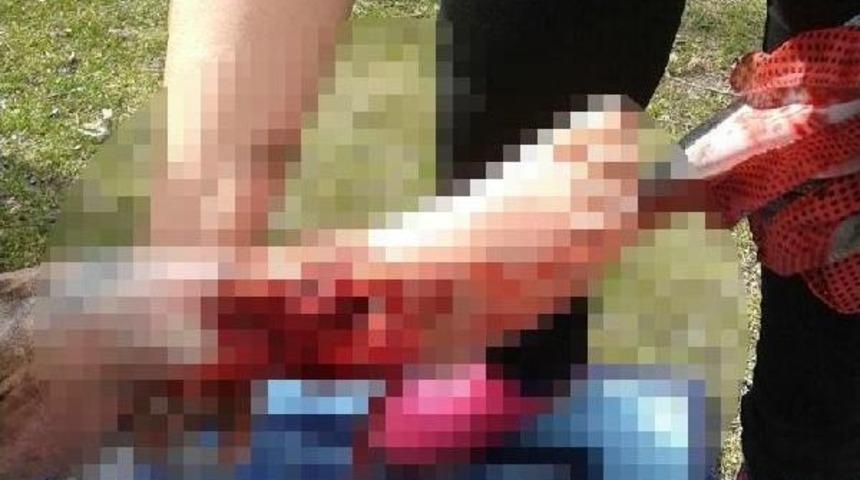 Balık Merakı Ayağından Ediyordu