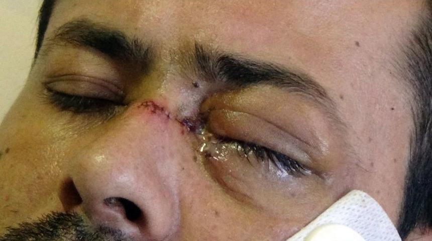 Servisi Beğenmediği İ&ccedil;in Garsonu Bı&ccedil;aklayan Şahıs Yakalandı