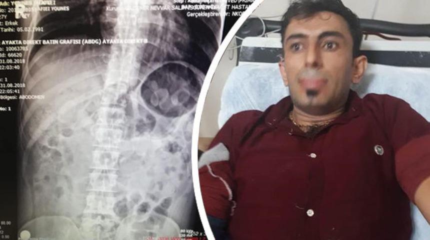 Midesinden 30 kapsül uyuşturucu çıktı