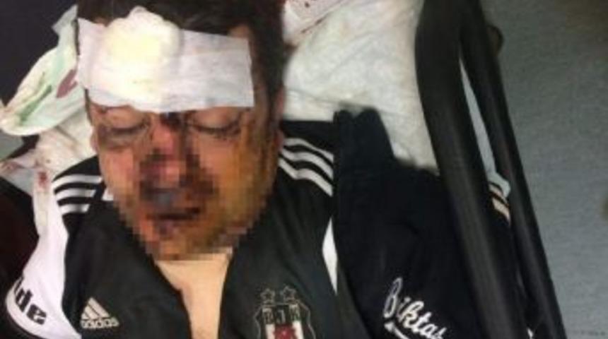 Otob&uuml;sten D&uuml;şen Beşiktaş Taraftarı Hayati Tehlikeyi Atlattı