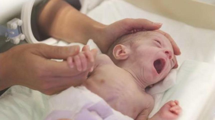 Üçüz Parmak Bebekler Sağlıklarına Kavuştu