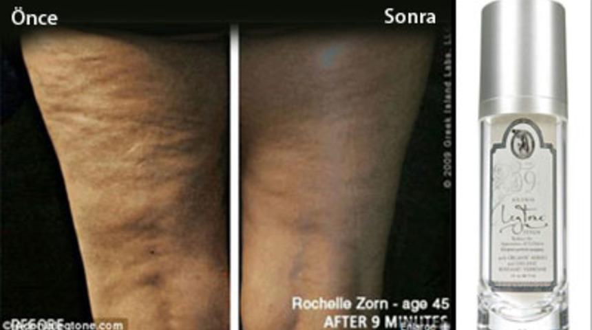 Sel&uuml;litten 9 Dakikada Kurtulun