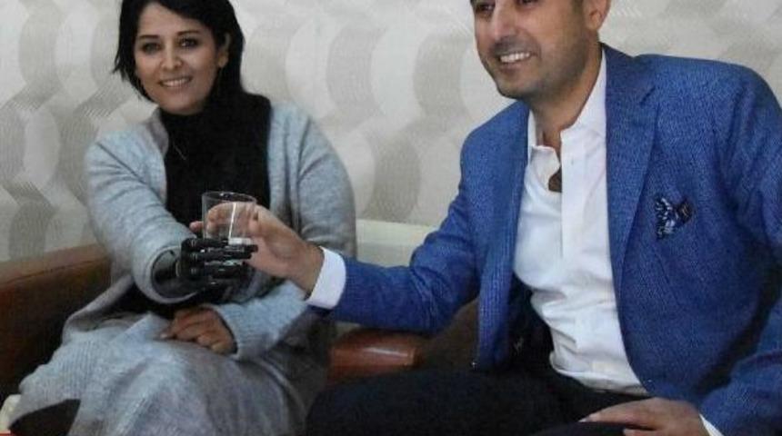 Gen&ccedil; Kızın Biyonik Kol Mutluluğu