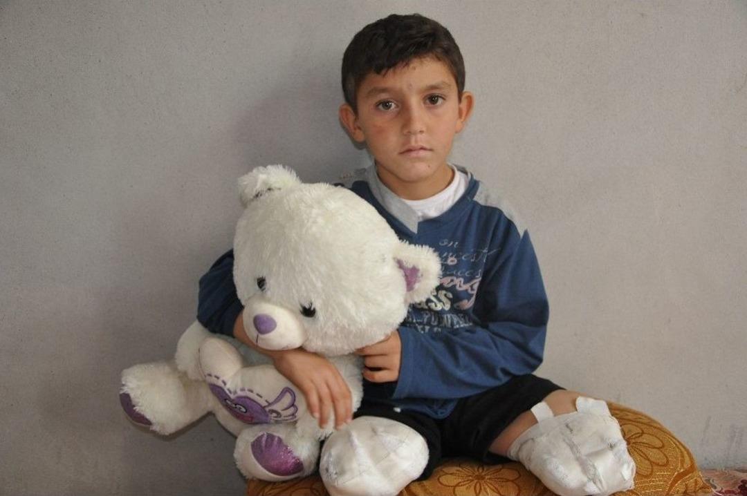 İki Bacağı Kopan Abdulbasit&rsquo;in Hayali &Ccedil;ocuk Doktoru Olmak