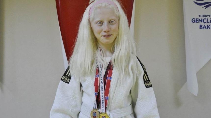 Hem Korkusunu Hem De Rakiplerini Yendi