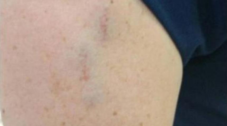 Acil Serviste Hemşireye Saldırı Iddiası