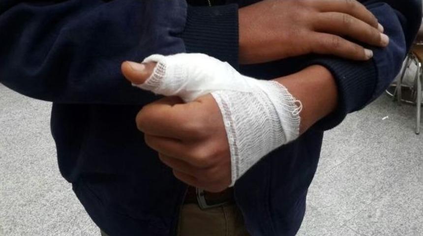 K&ouml;peğin Saldırdığı Suriyeli Gen&ccedil; Yaralandı