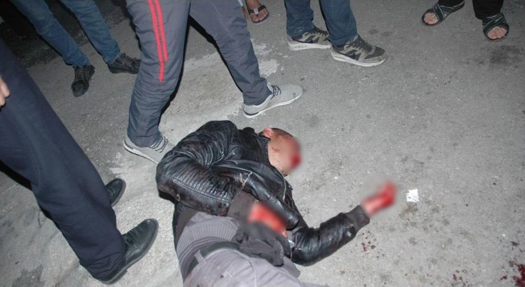 &Ouml;nce D&ouml;vd&uuml;ler Sonra Polise Teslim Ettiler