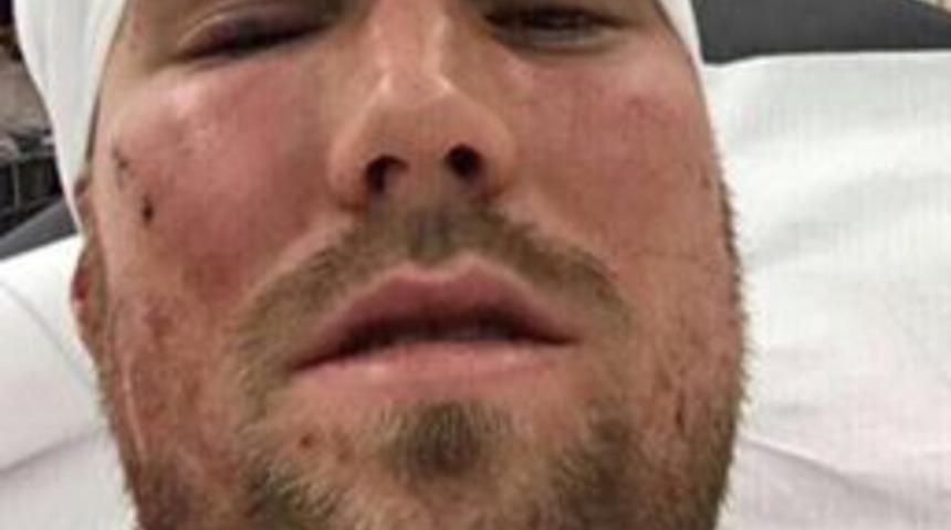 Alman Basınından Flaş İddia: "grosskreutz’u Hastanelik Eden 16 Yaşında Bir Türk"