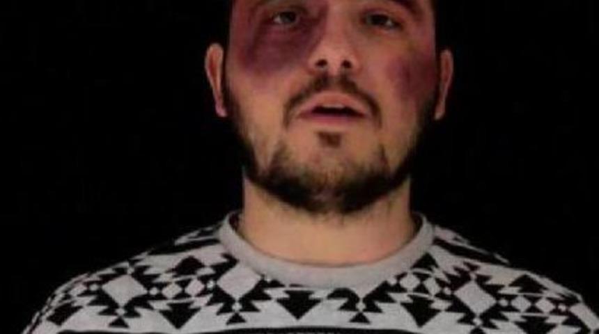 Erkekler Kadına Şiddeti Mor Makyaj Ve Sargı Beziyle Anlattı