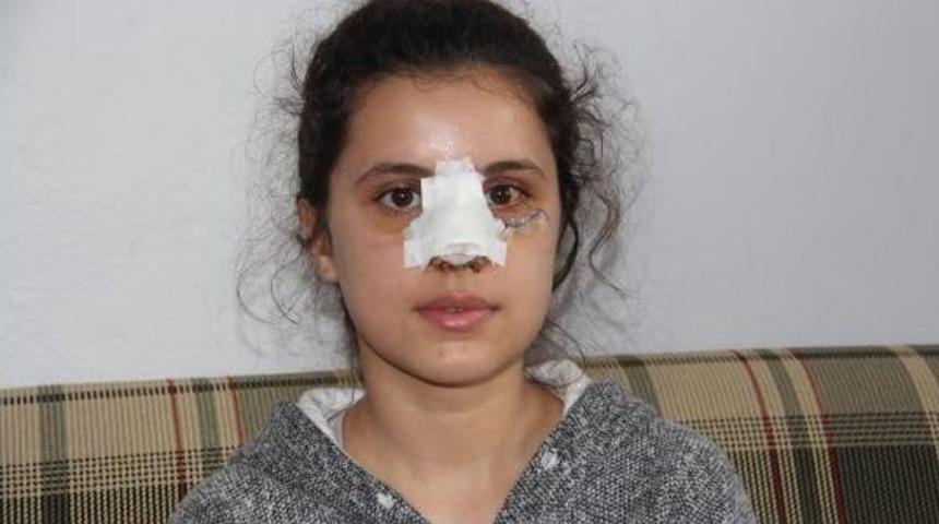 Uyuşturucu Bağımlısı, 13 Yaşındaki Kıza Sopayla Saldırıp Burnunu Kırdı