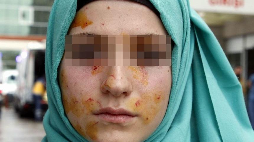 Lise Öğrencilerinin Kavgası Hastanede Bitti