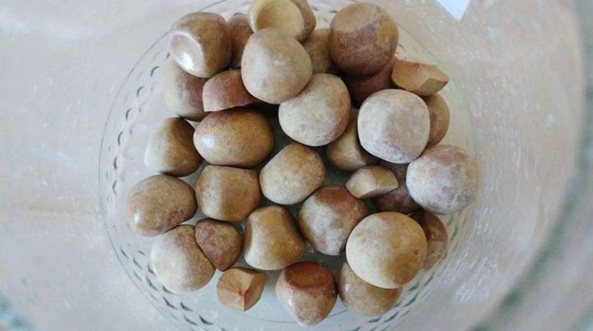 Doktorları Şaşkına Çeviren Olay