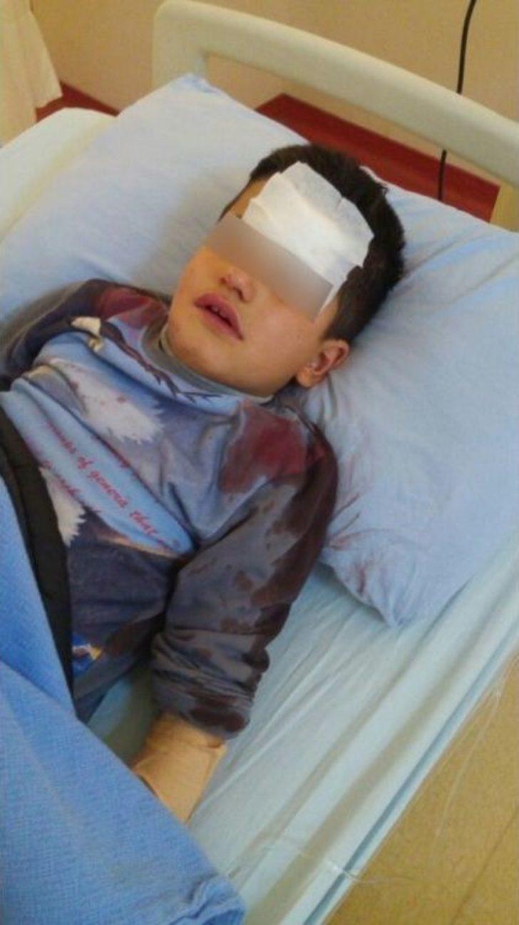 Üzerine Kapı Devrilen Öğrenci Yaralandı G5