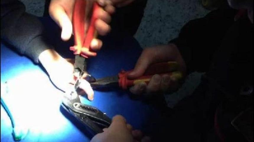 Hastanede Parmak Kurtarma Operasyonu