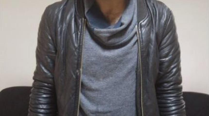 Arkadaşının Y&uuml;z&uuml;n&uuml; Bu Hale Getirdi