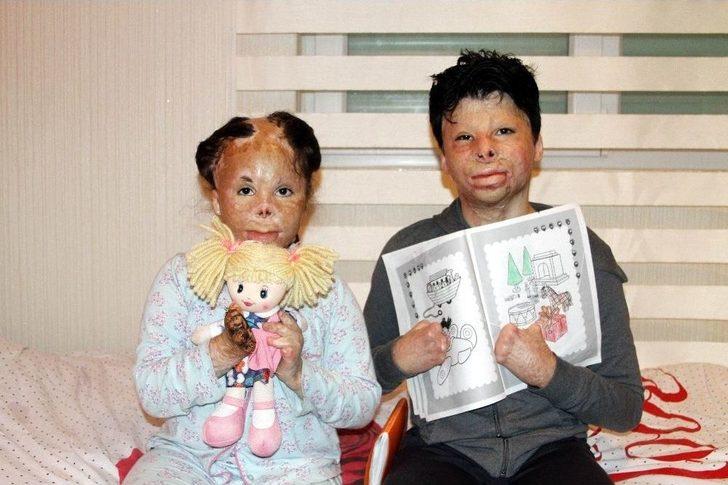 Halep’te Bombalı Saldırıda Elleri Ve Yüzleri Yanan Suriyeli Kardeşlerin Yardım Çığlığı G1