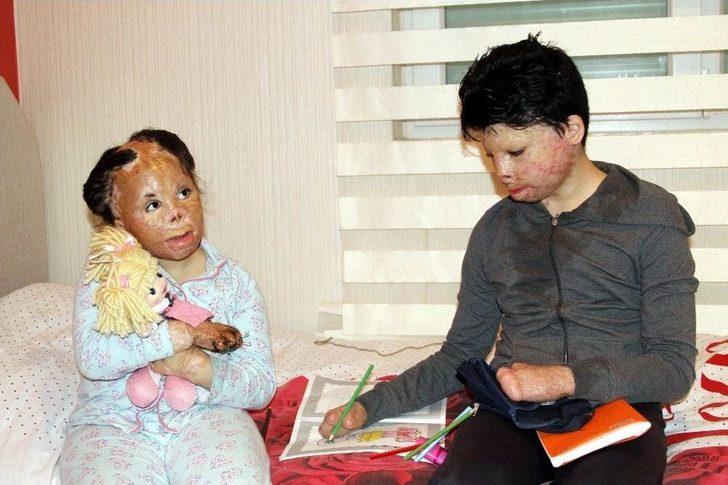 Halep’te Bombalı Saldırıda Elleri Ve Yüzleri Yanan Suriyeli Kardeşlerin Yardım Çığlığı G5