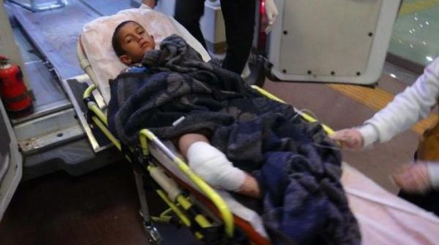 D&uuml;ğ&uuml;n Magandası 7 Yaşındaki Adnan'ı Yaraladı