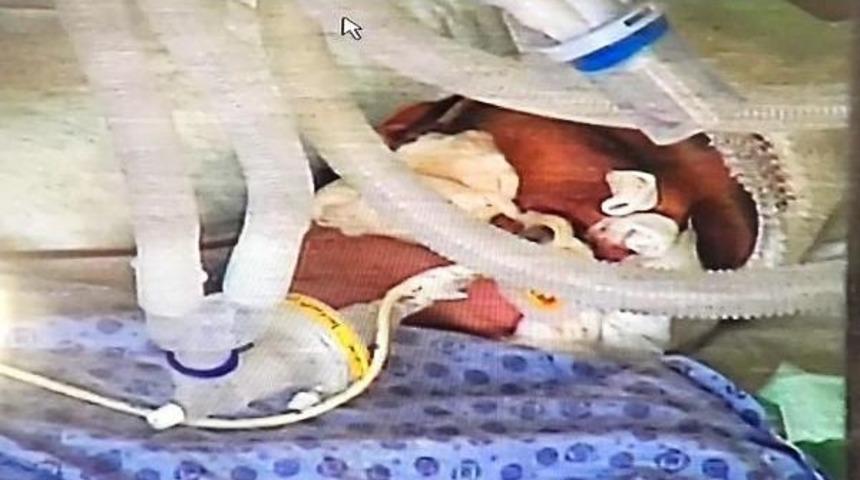 Eşinin Uyurkan Satırla Başına Vurduğu Kadın Hastanede &Ouml;ld&uuml;