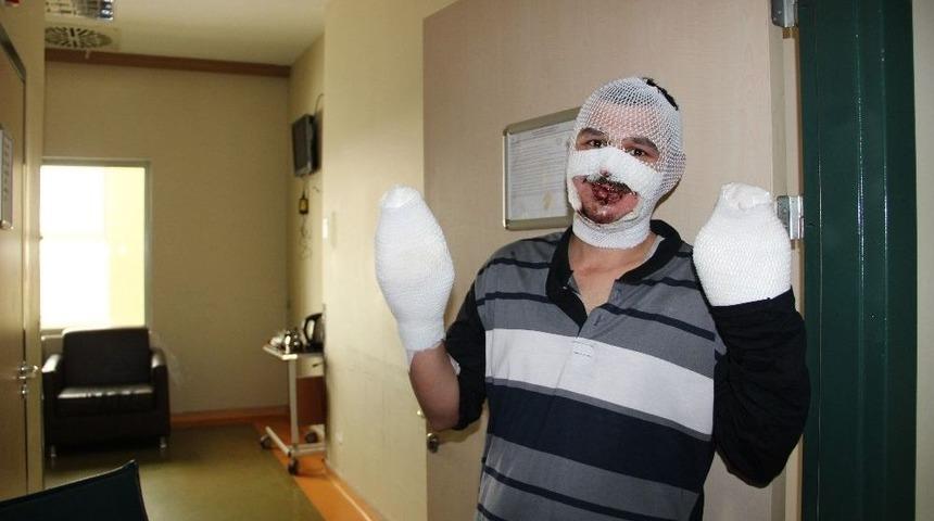 Sobaya Benzin D&ouml;kt&uuml; Yandı