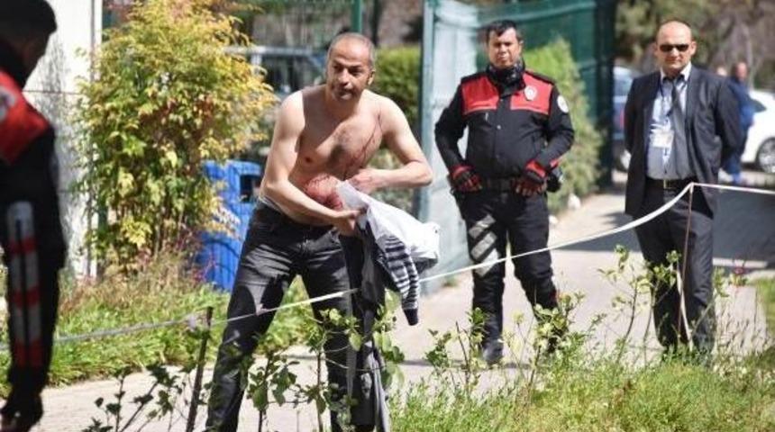 Tedavi Edilmediğini Iddia Ederek Kendini Kesti