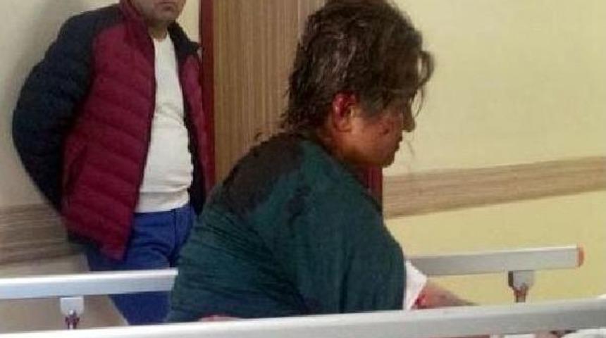 K&ouml;peklerin 80 Yerinden Isırdığı Kadın Ağır Yaralandı