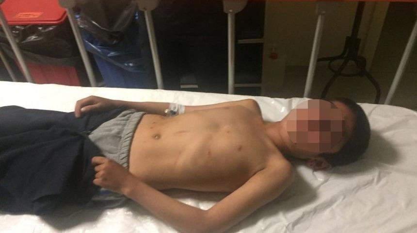 Pazar Yerinde Silahlar Konuştu: 6 Yaralı